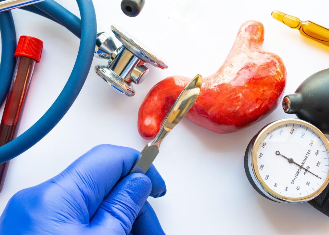 Cirurgia Bariátrica - 6 passos para saber se o tratamento é ideal para você Cirurgia Bariátrica - 6 passos para saber se o tratamento é ideal para você