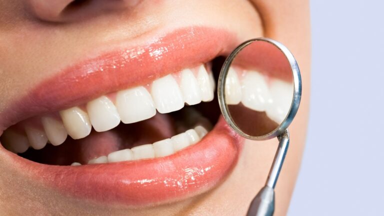Como colocar dentes de porcelana? O Guia simplificado!