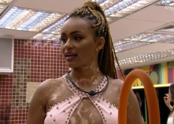 O que é o vitiligo?