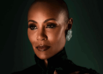 Alopecia, doença de Jada Smith, pode ser causada por estresse ou gatilho emocional