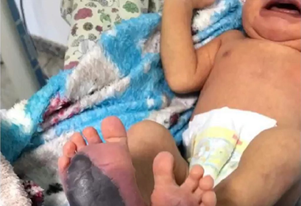Mãe de bebê com doença rara clama por ajuda em Ouro Preto: "Isso não é humano"