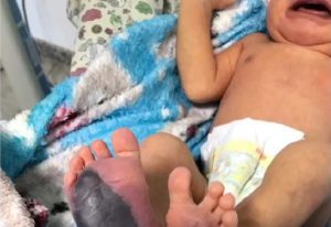 Mãe de bebê com doença rara clama por ajuda em Ouro Preto: “Isso não é humano” Mãe de bebê com doença rara clama por ajuda em Ouro Preto: "Isso não é humano"