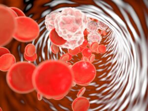 Qual o problema da inflamação?