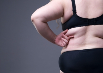 Aceite as diferenças. Gordofobia não!