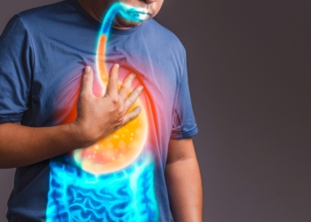 Aquela queimação que todo mundo já teve um dia