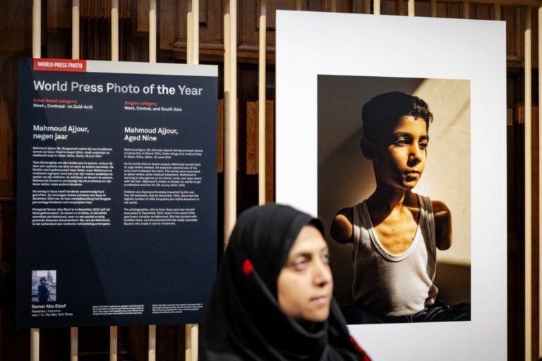 Fotógrafa palestina vence World Press Photo 2025 com retrato de menino que perdeu os dois braços em bombardeio