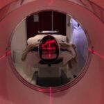 UFMG recruta voluntários para pesquisa sobre efeitos da quimioterapia no cérebro