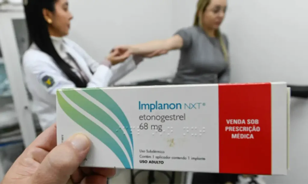 Ouro Preto passa a oferecer implante contraceptivo Implanon na rede pública de saúde Ouro Preto passa a oferecer implante contraceptivo Implanon nas unidades de saúde
